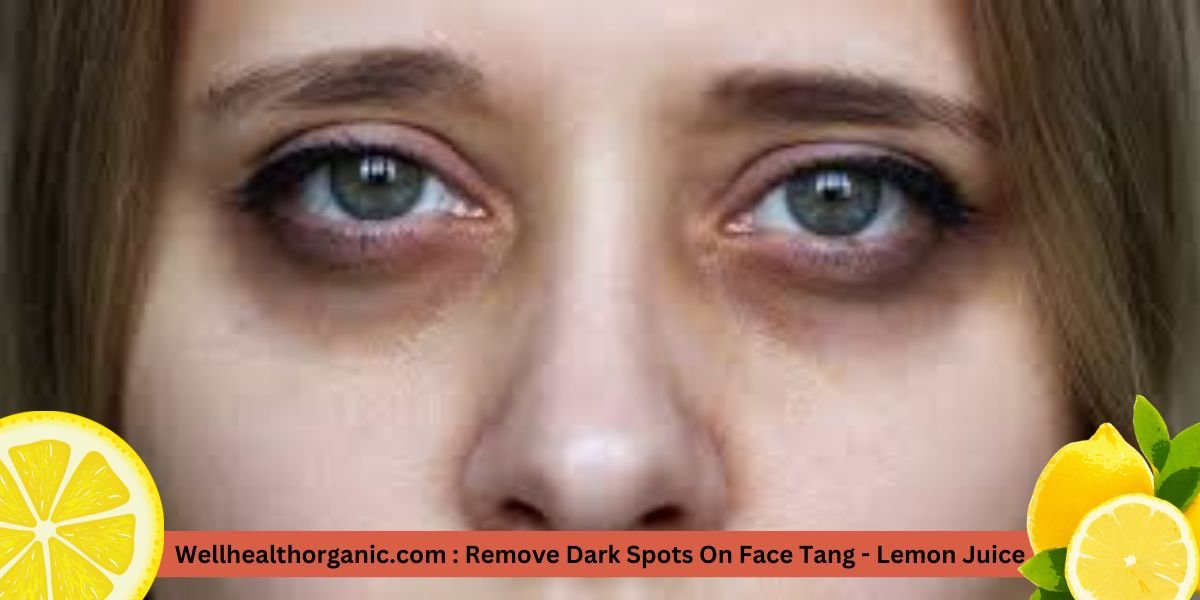 Wellhealthorganic.com : Remove Dark Spots On Face Tang – Lemon Juice